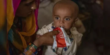 Pakistan critically short of supplementary food for acute child malnutrition: Unicef